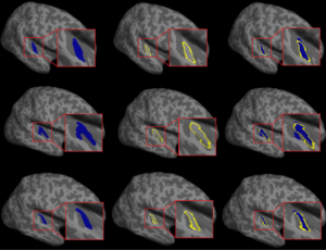 Heschl’s Gyrus segmentation tool from our lab